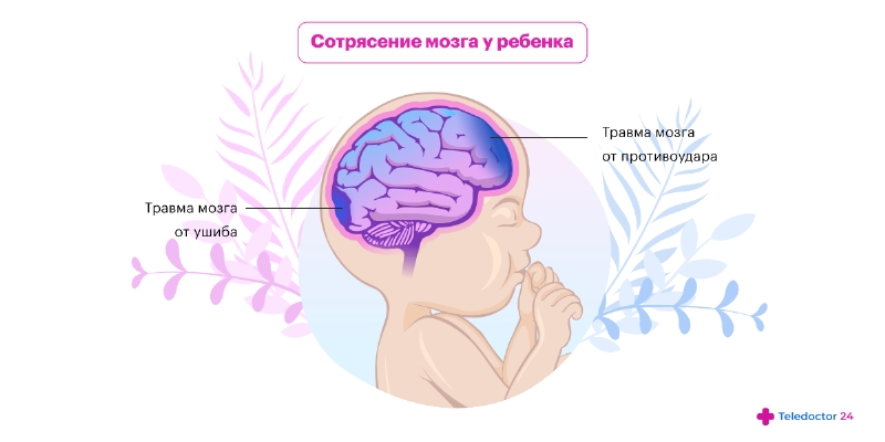 Профилактика сотрясения мозга у ребенка в домашних условиях