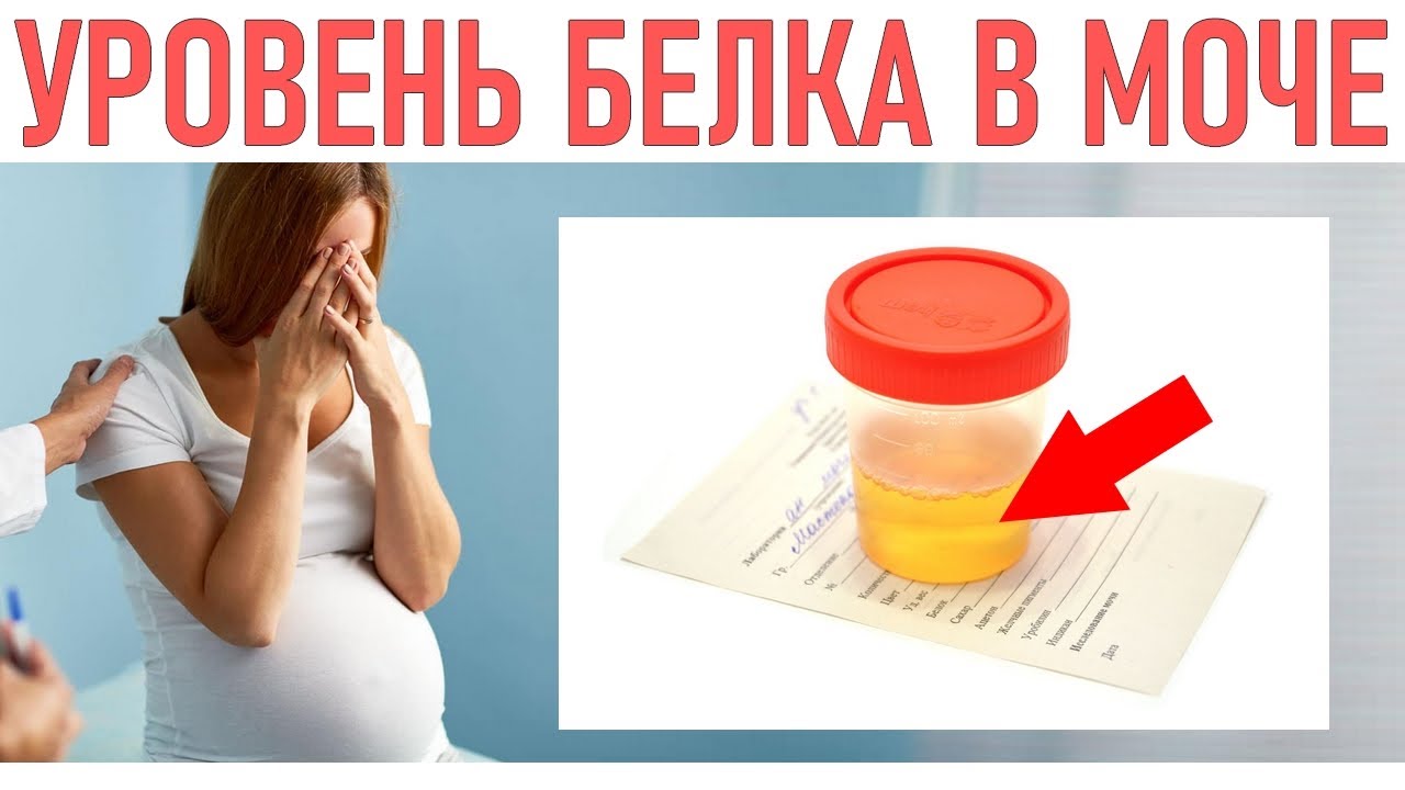 Норма белка в моче при беременности